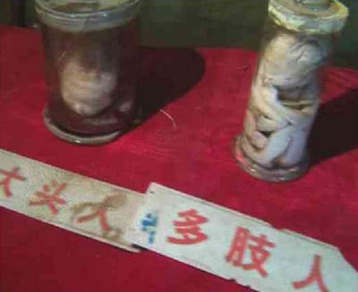 美食節(jié)展覽現(xiàn)嬰兒標本